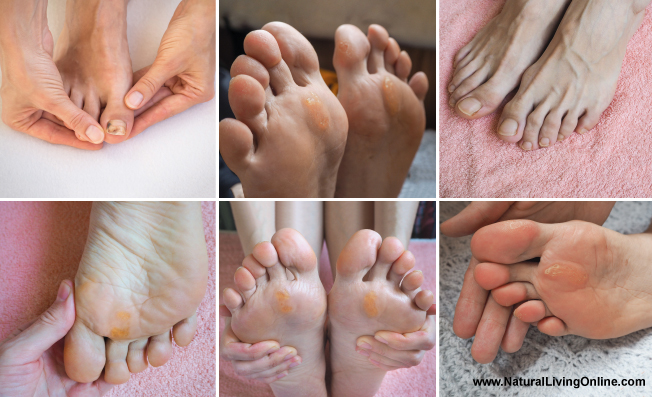 Epsom Salt for Feet: Benefits, Uses, and Recipes - Natural Living (1)